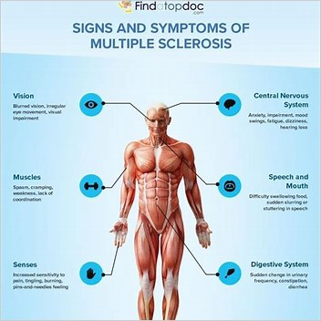 Multiple Sclerosis Signs And Symptoms All Articles With Unsourced Statements